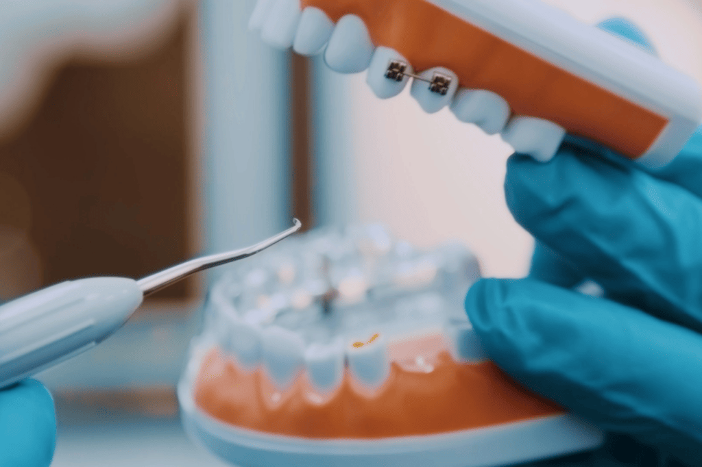 Mají neviditelná rovnátka nevýhody? Co byste měli vědět před zahájením léčby obrázek 2 Mají neviditelná rovnátka nevýhody? Co byste měli vědět před zahájením léčby obrázek 1